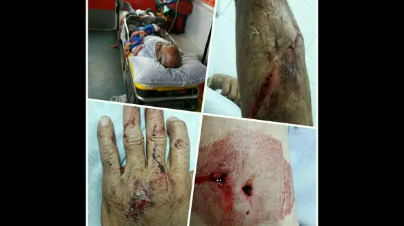 حمله خونین پلنگ به پیرمرد  خلخالی + عکس 