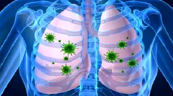 عفونت تنفسی و خطر بیماری قلبی تا ۱۷ برابر افزایش