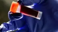 این گروه خونی بیشترین احتمال سکته مغزی را دارد!