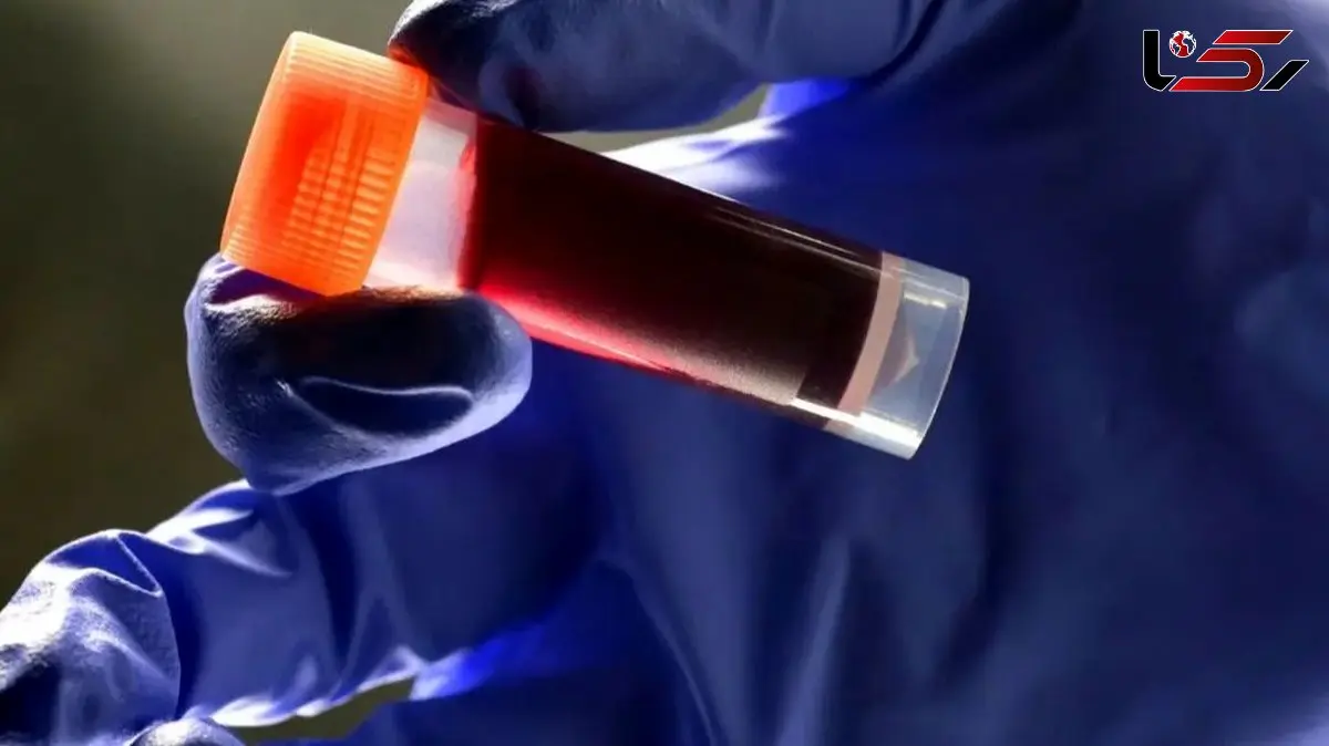 این گروه خونی بیشترین احتمال سکته مغزی را دارد!