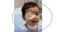 خطای عجیب در اتاق عمل یاسوج؛ نوزاد به جای چشم زیر تیغ جراحی لوزه رفت + واکنش وزارت بهداشت
