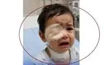 خطای عجیب در اتاق عمل یاسوج؛ نوزاد به جای چشم زیر تیغ جراحی لوزه رفت + واکنش وزارت بهداشت