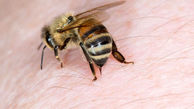 نیش زنبور با بدن چه می کند؟