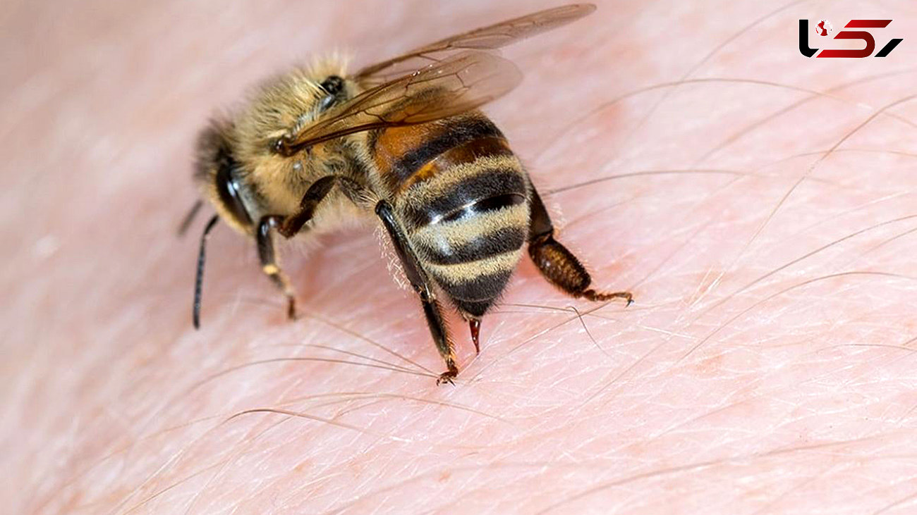 نیش زنبور با بدن چه می کند؟