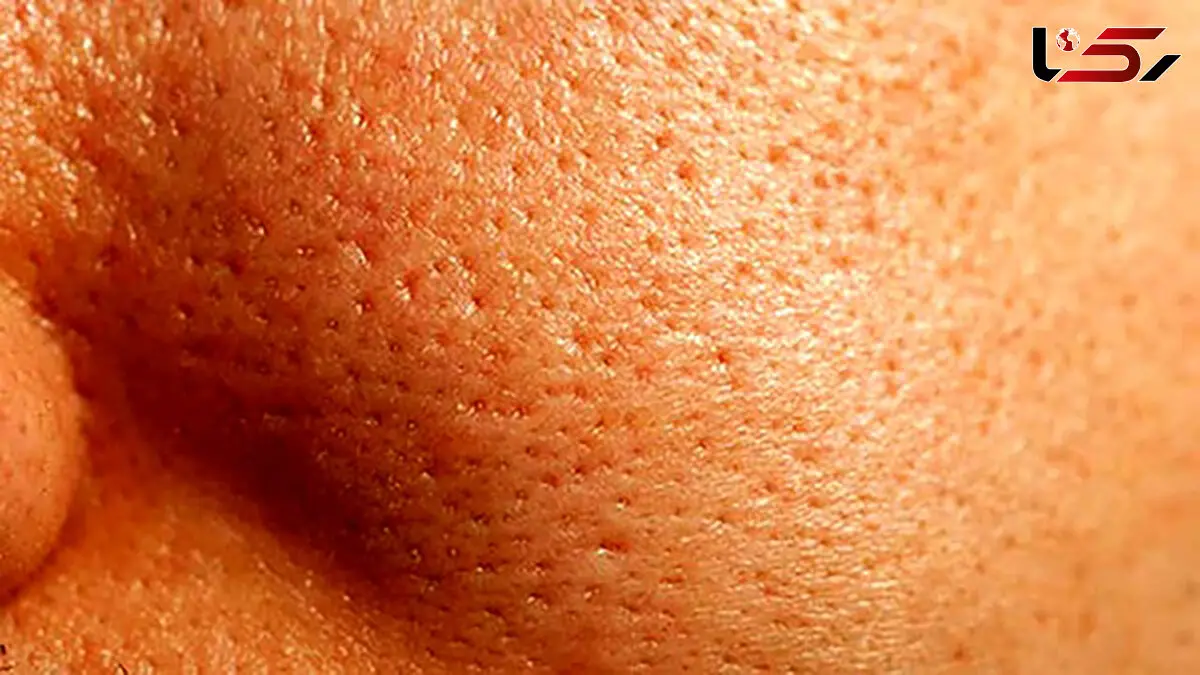 عادت های زشت پوستی که باید ترک کنید 
