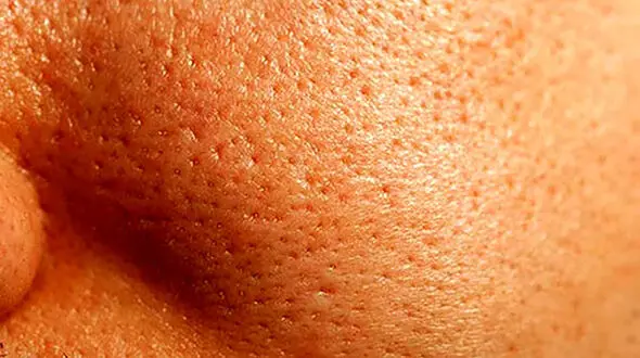 عادت های زشت پوستی که باید ترک کنید 