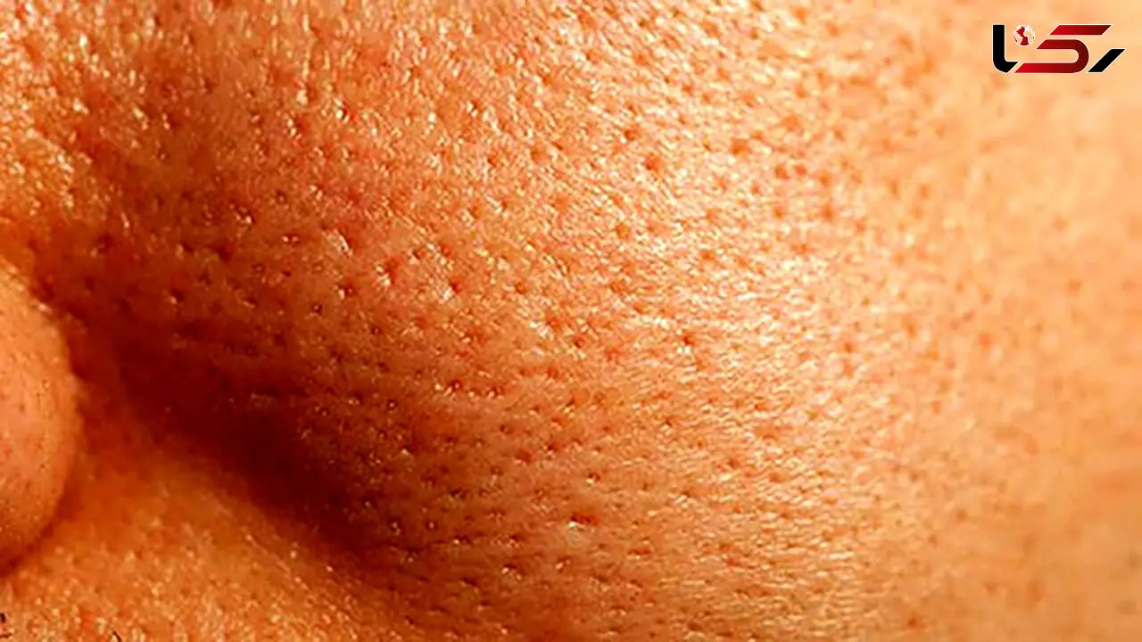 عادت های زشت پوستی که باید ترک کنید 