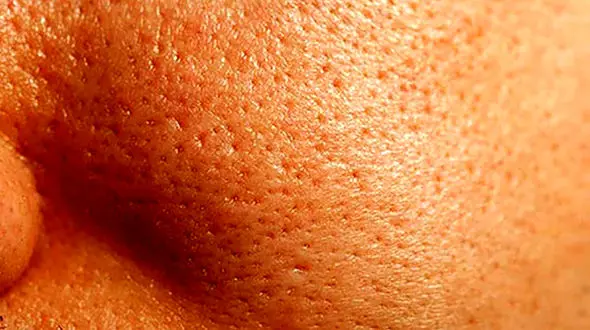 عادت های زشت پوستی که باید ترک کنید 