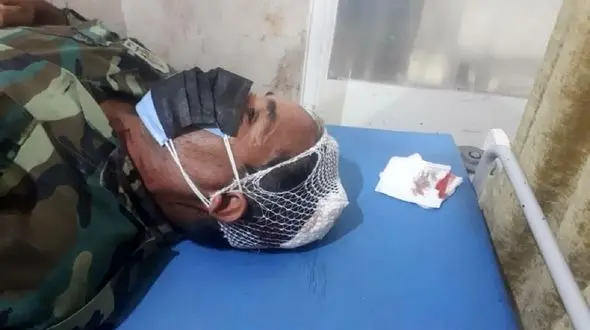 دامدار تبر به دست جنگلبان گلستانی را راهی بیمارستان کرد +عکس