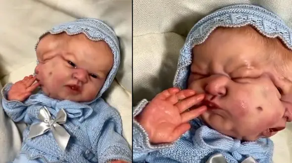 فیلم راز نوزاد عجیب الخلقه که انسان نیست ! / کودکی با 2 سر  !