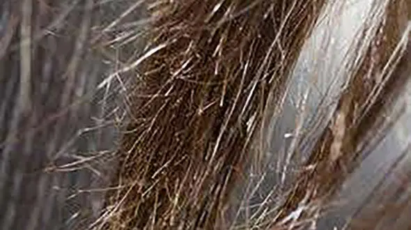 درمان های طبیعی موخوره 