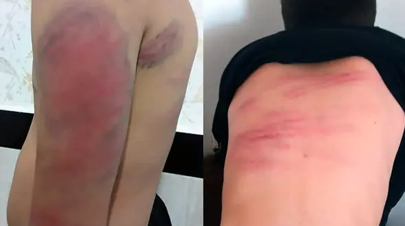 ابراهیم‌پور : سه شنبه این هفته مسئولان آموزش و پرورش در مجلس حاضر می شوند / علت افزایش تنبیه بدنی دانش آموزان در مدارس است