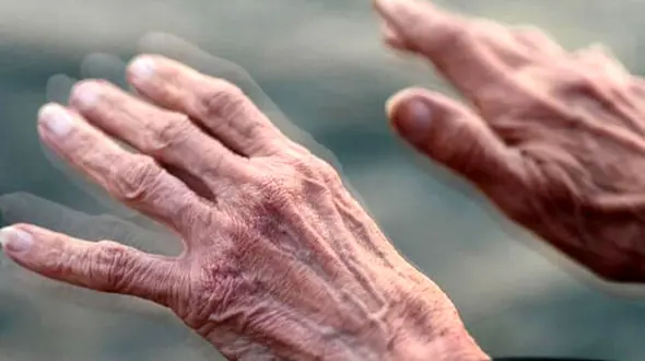 خطر پارکینسون از 50 سال به بالا 