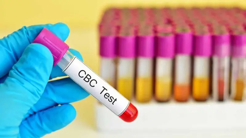 تست CBC