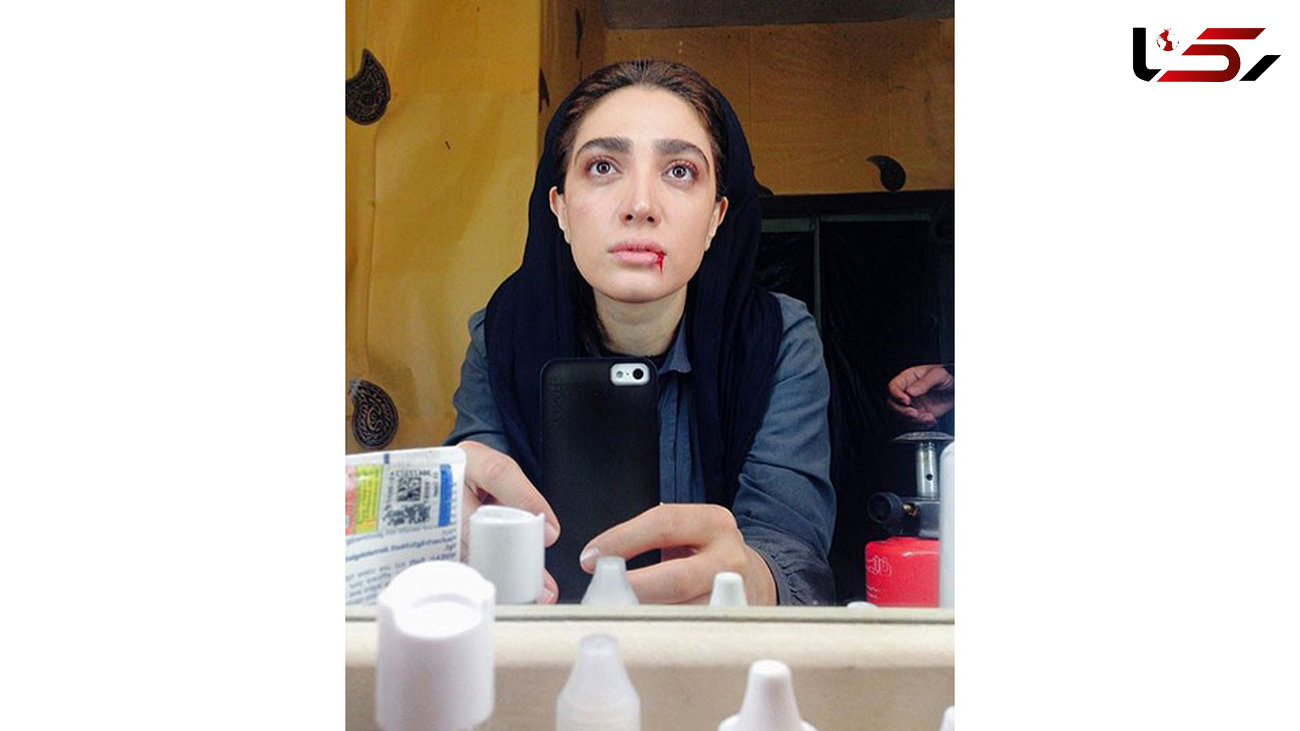 همسر بازیگر معروف ایرانی عکس جدیدش را با لب های خونی انتشار داد! +عکس 