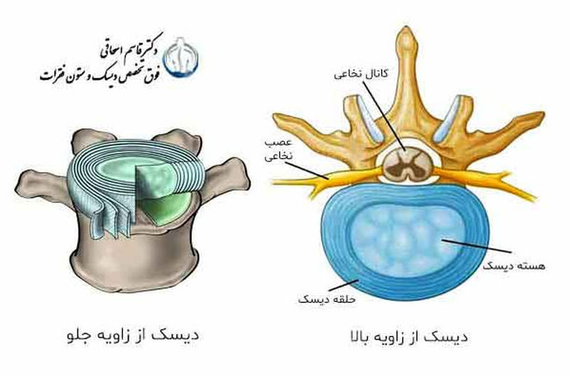 حلقه دیسک