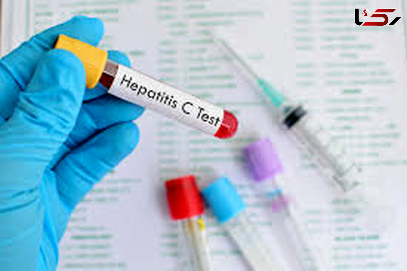 چند دستور بهداشتی برای جلوگیری از انتقال هپاتیت C به دیگران