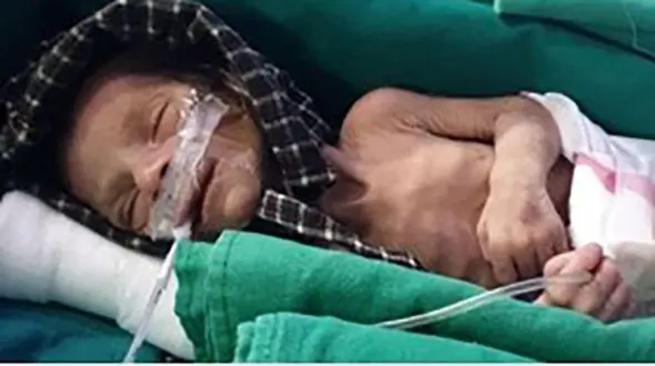 زنده به گور کردن نوزاد ناخواسته ! / یک مرد گریه های نوزاد را شنید  + عکس / هند