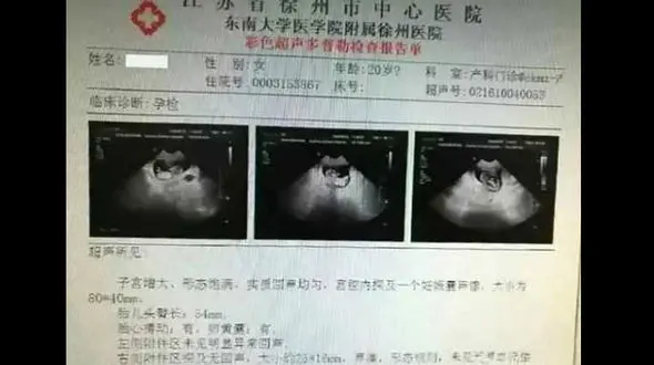 راز عجیب مرد 40 ساله و دختر 12 ساله خارجی در سونوگرافی لو رفت+عکس