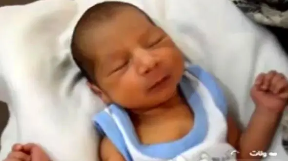 تولد یک نوزاد عجیب الخلقه در گناباد + فیلم