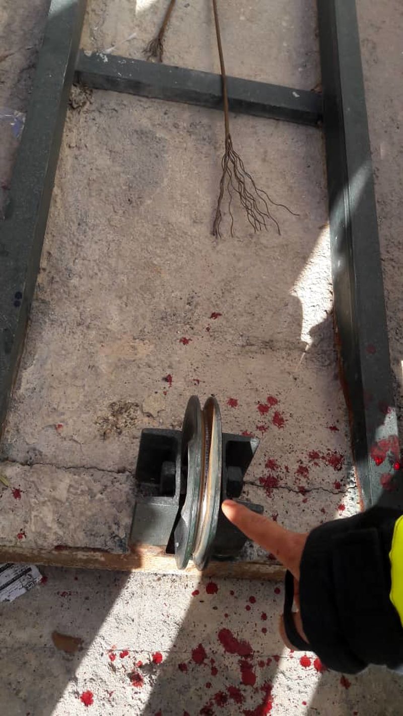 3 عکس از قطع انگشت دختر 11 ساله در شیراز  
