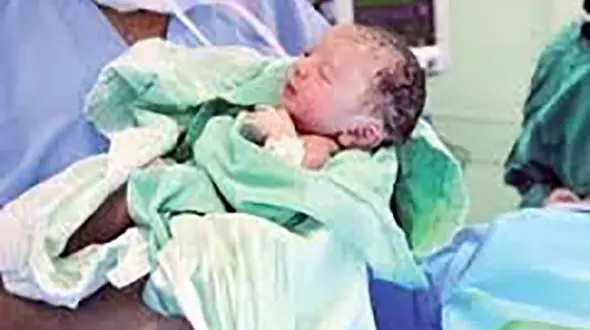 تولد نوزاد متولد شده از مادر مبتلا به کرونا در ساوه