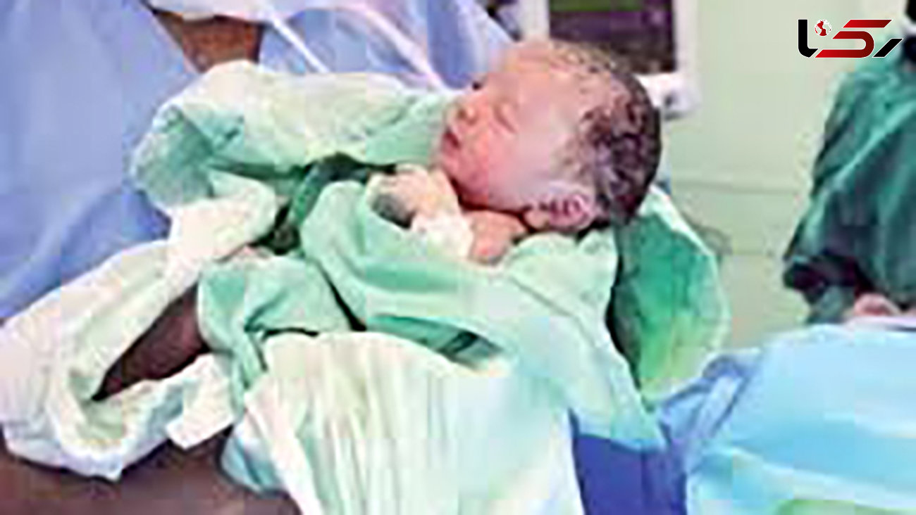 تولد نوزاد متولد شده از مادر مبتلا به کرونا در ساوه