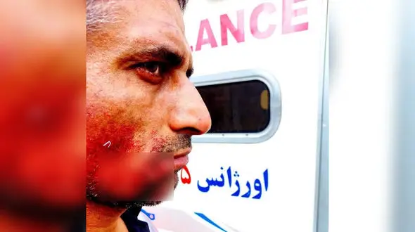 عکس وحشتناک از حمله خونین سگ ولگرد به کارگر شهرداری فردیس + جزییات