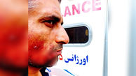 عکس وحشتناک از حمله خونین سگ ولگرد به کارگر شهرداری فردیس + جزییات