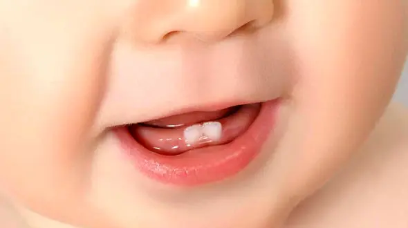 بوی بد دهان بچه ها را جدی بگیری