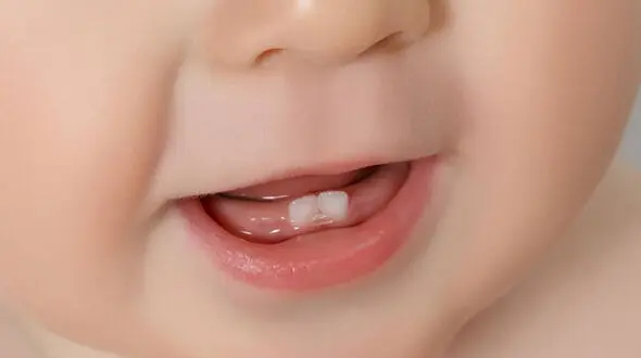 بوی بد دهان بچه ها را جدی بگیری