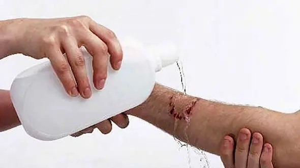 ۲ همت از بودجه درمانی مردم در گلوی سگ های ولگرد !