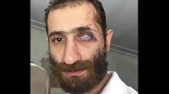 فیلم اعتراف بازیگر مشهور ایرانی به کتک خوردن از خانم بازیگر / دستش خیلی سنگین است !