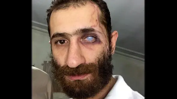 فیلم اعتراف بازیگر مشهور ایرانی به کتک خوردن از خانم بازیگر / دستش خیلی سنگین است !