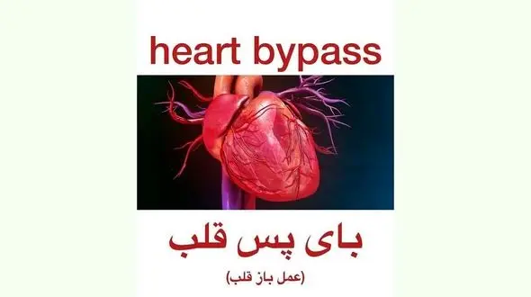 بای پس قلب چیست ؟ / فیلم جراحی قلب را ببینید 