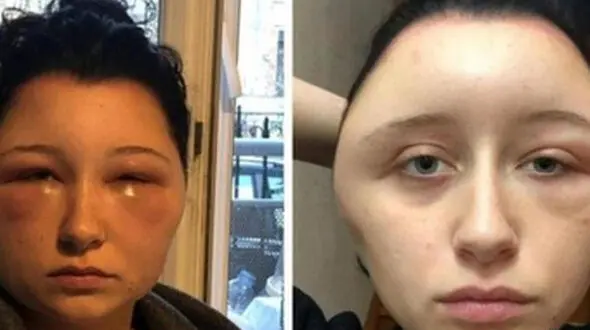 رنگ موی تقلبی باعث تغییر کردن وحشتناک صورت این زن شد +عکس

