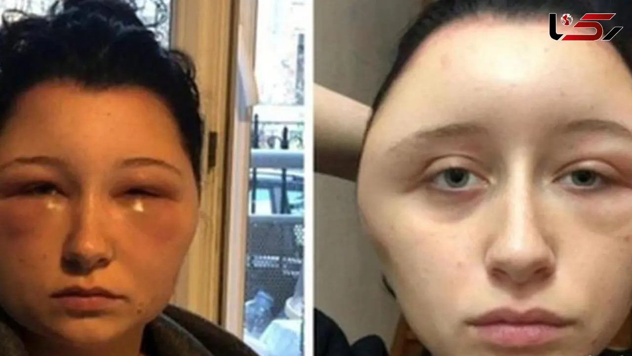 رنگ موی تقلبی باعث تغییر کردن وحشتناک صورت این زن شد +عکس

