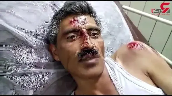 فرمانده یگان حفاظت منابع طبیعی خلخال به شدت متم خورد+ عکس دردناک