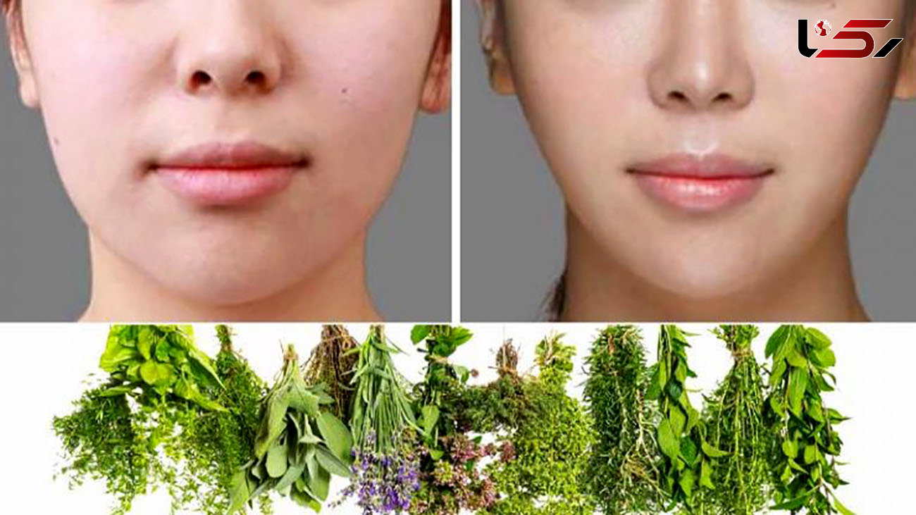 10 داروی گیاهی برای لاغر شدن صورت