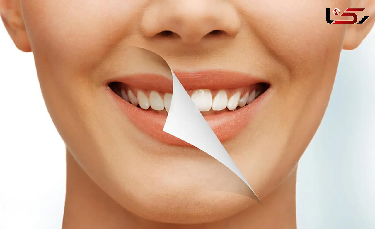رهایی از جرم دندان با روش های طبیعی و بدون هزینه