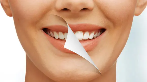 رهایی از جرم دندان با روش های طبیعی و بدون هزینه