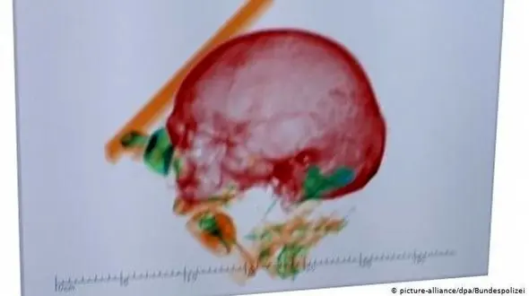 چمدان 2 زن مسافر حاوی اسکلت یک مرد بود! / در فرودگاه فاش شد + عکس / مونیخ