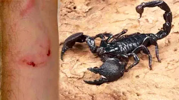 عقرب زدگی دختر 22 ساله اهوازی را کشت! + علائم و روش نجات از عقرب زدگی