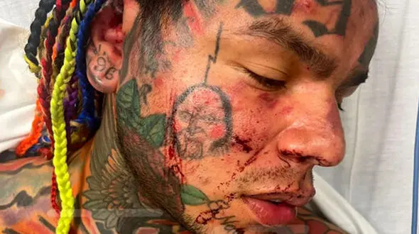 ببینید /  ویدیویی از کتک زدن وحشیانه خواننده آمریکایی در یک باشگاه ورزشی! + فیلم