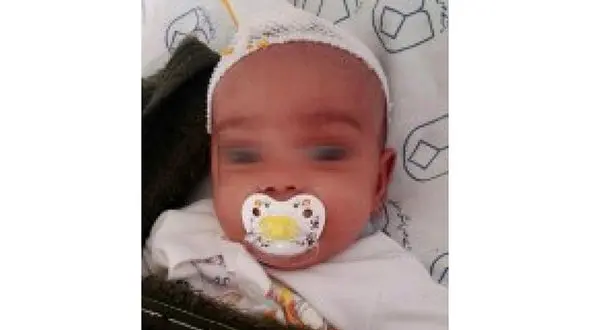 ضربه مغزی نوزاد اصفهانی توسط پدر شکنجه گر+ عکس