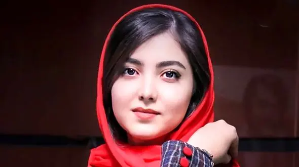 وقتی زیبا کرمعلی جهت خاص بازی رو مانتوش سنجاب بیچاره رو دوخت!