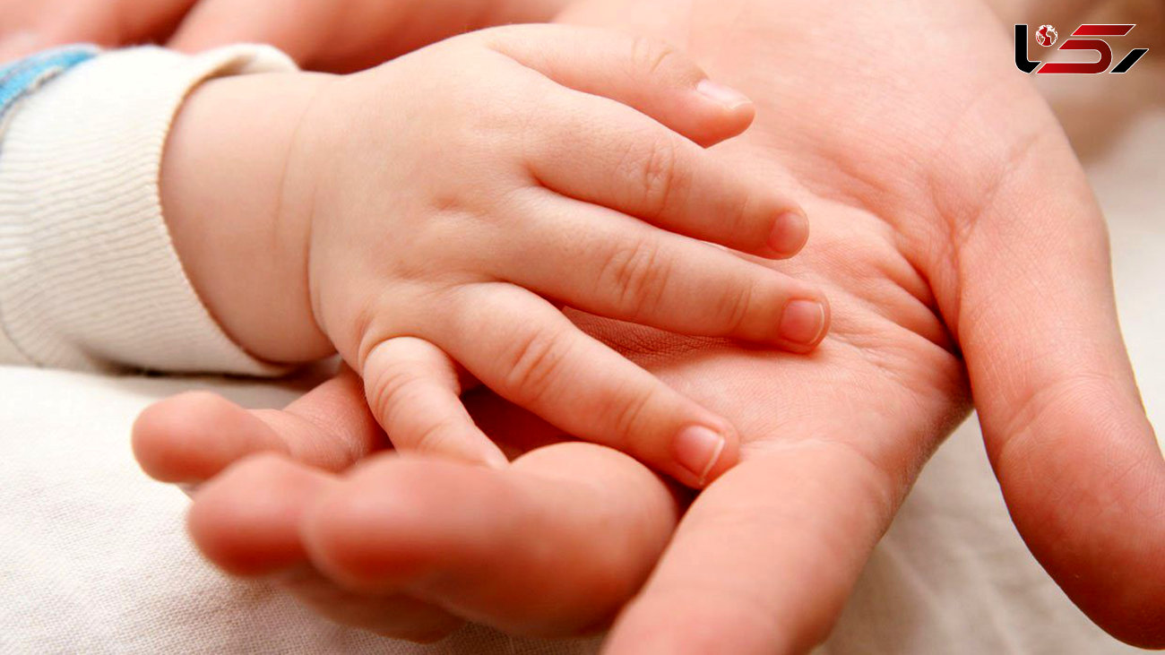 بررسی عارضه مادرزادی چسبیدن انگشتان دست + درمان