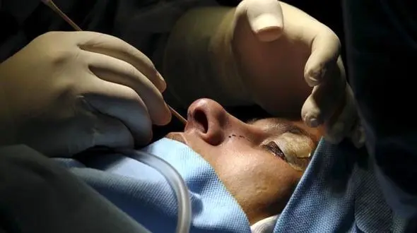 این دستگاه تاثیری بر کوچک کردن بینی ندارد/زیبایی های فریبنده تقلبی