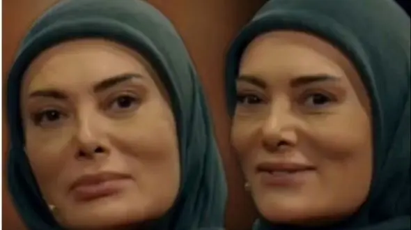 فیلم/ نگار فروزنده و عمل جراحی که در حین عمل به هوش آمد؛ دکتر فکر کرد غلو میکنم / یک بار مرگ کامل و تجربه کردم