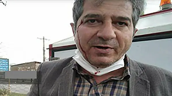 دبیر مدیریت کرونا را در الیگودرز به باد کتک گرفتند + عکس